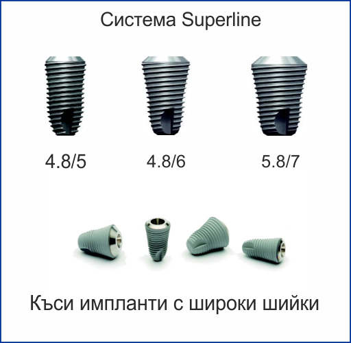 Къси импланти с широки шийки